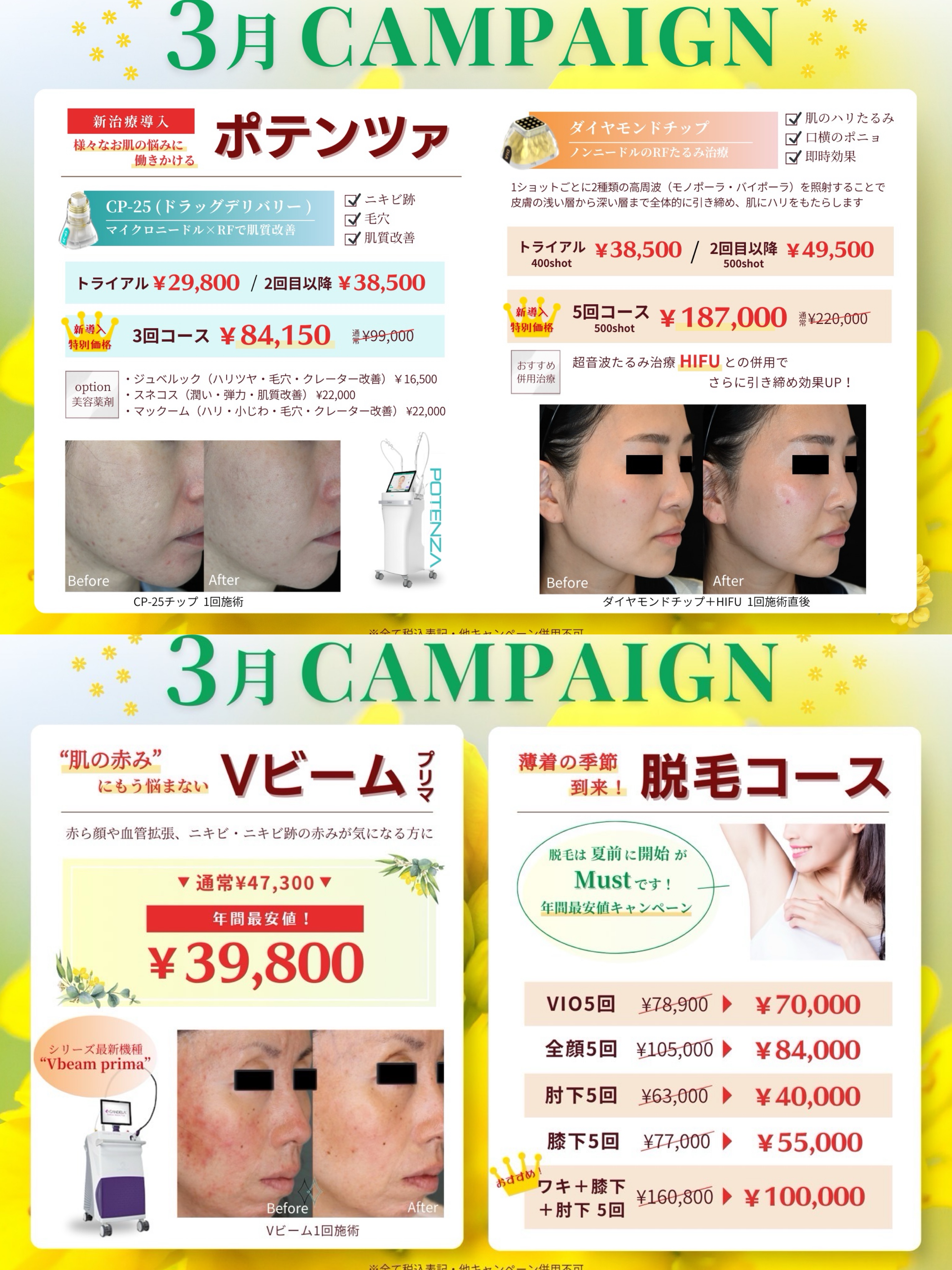 3月campaign