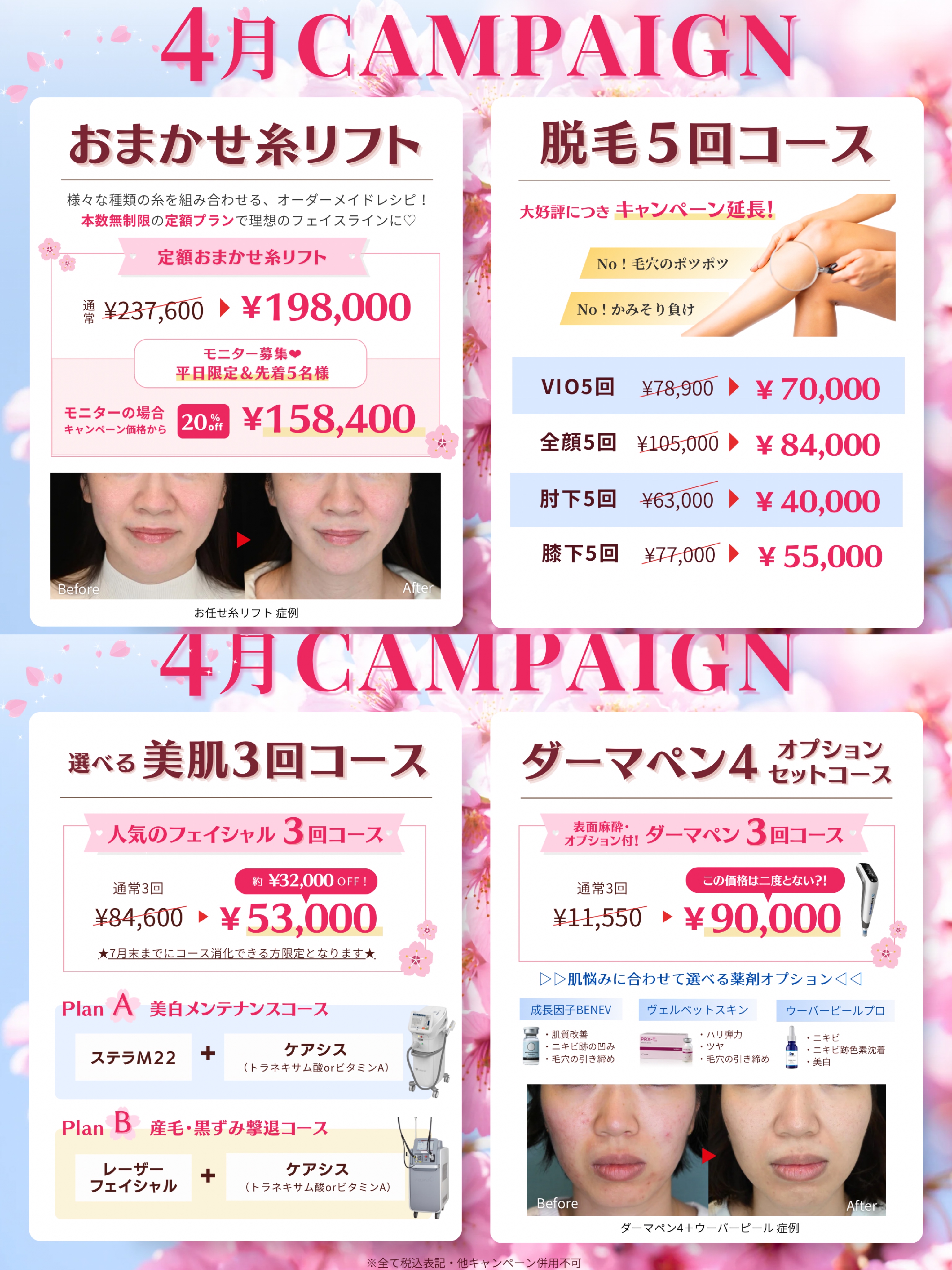 4月campaign