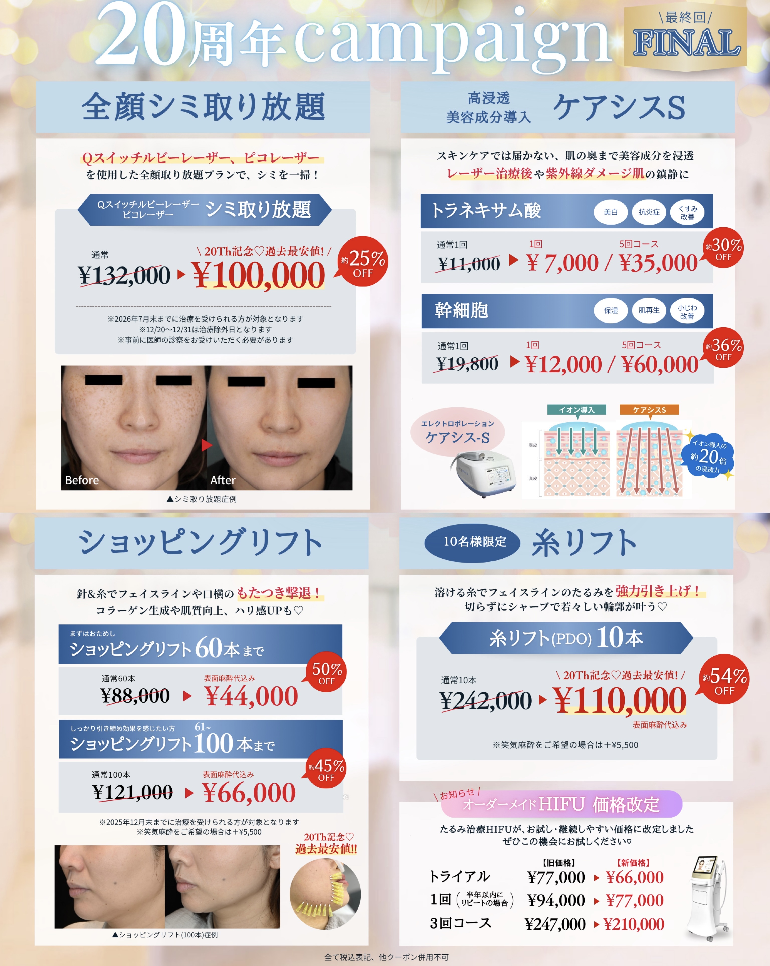 7月campaign