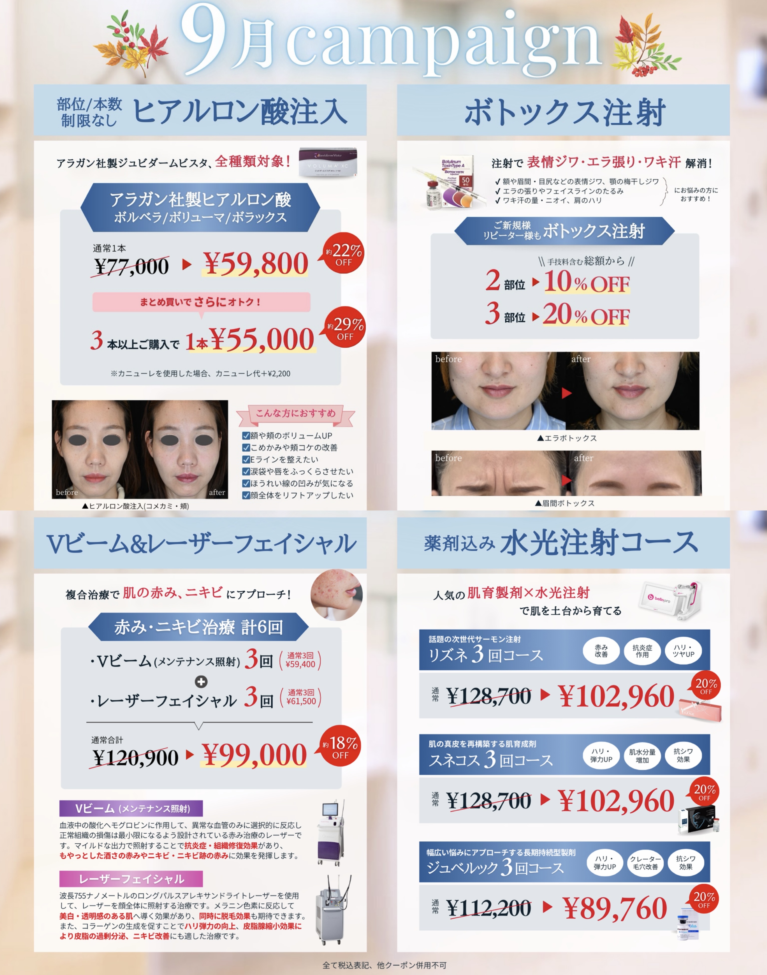 9月campaign