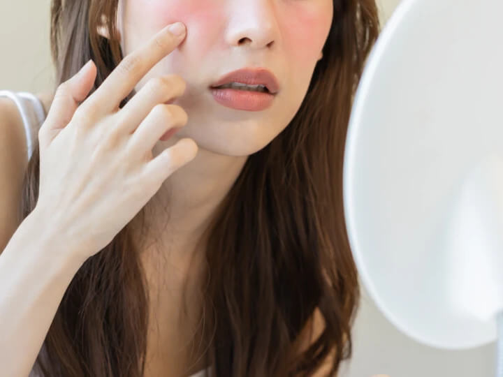 鏡で肌の赤みを確認する女性
